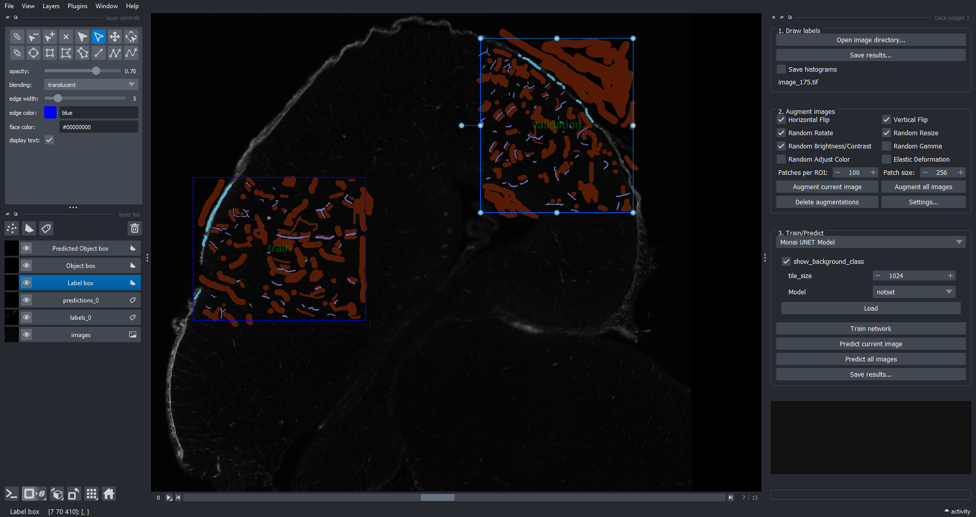 Sparse Train Validation Label