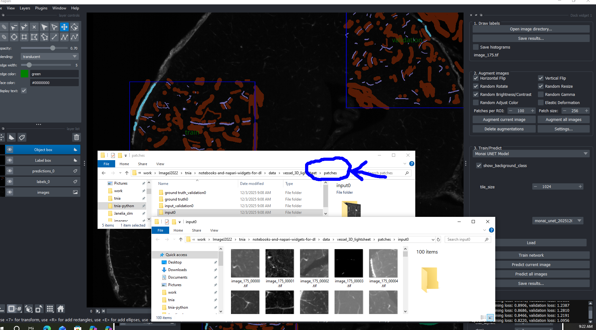 Troubleshoot Patches